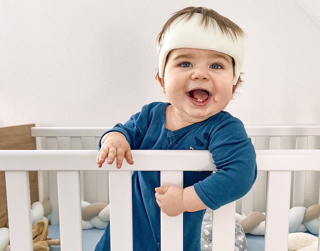 Das Bild zeigt ein Baby mit einer Kopforthese.