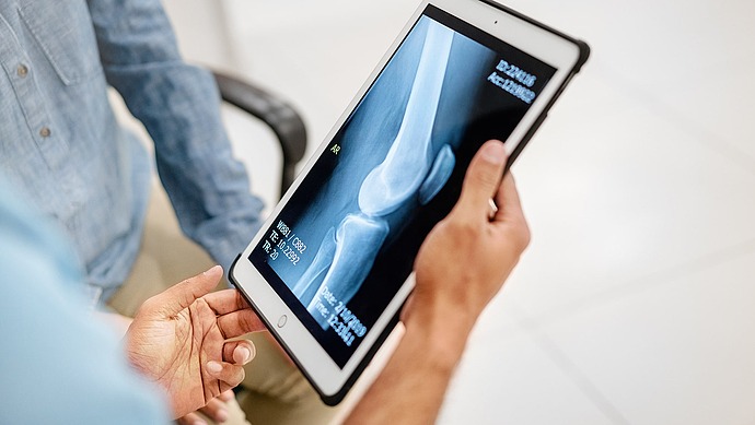 Eine Person hält ein Tablet in der Hand, auf dem ein Röntgenbild eines Knochens zu sehen ist, während eine andere Person in der Nähe sitzt und eine medizinische Beratung oder eine Diskussion über die Röntgenergebnisse vorschlägt.