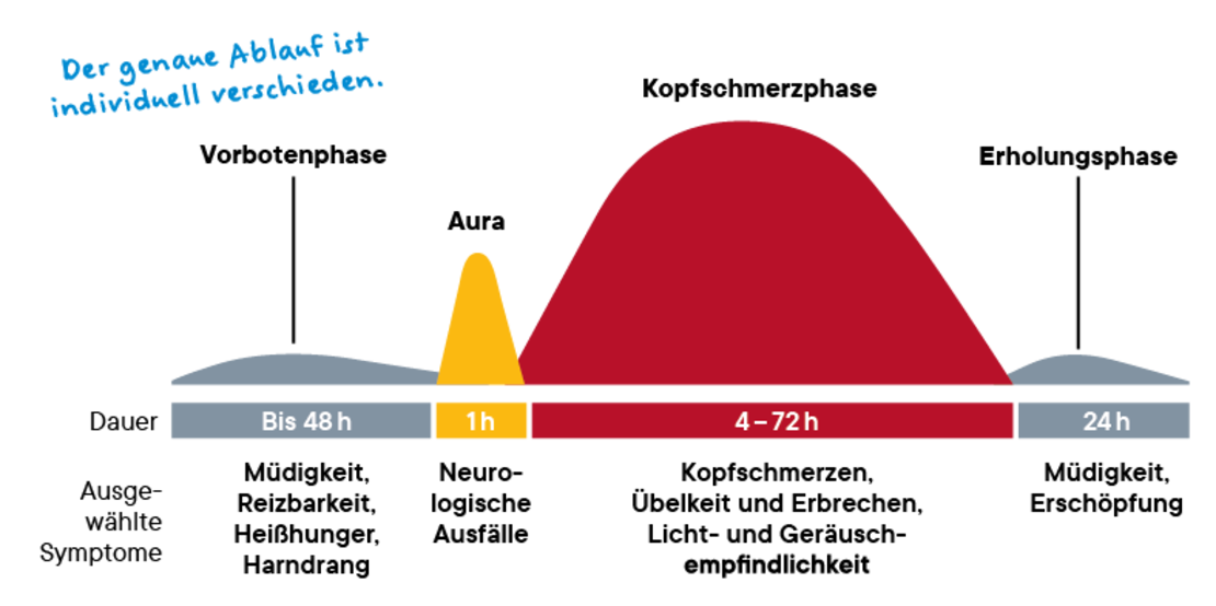 Schema der Migränephasen: Vorwarnphase (bis zu 48 Stunden, Müdigkeit, Reizbarkeit, Hunger), Aura (1 Stunde, neurologische Symptome), Kopfschmerzen (4-72 Stunden, Schmerzen, Übelkeit, Empfindlichkeit), Erholungsphase (24 Stunden, Müdigkeit, Erschöpfung).
