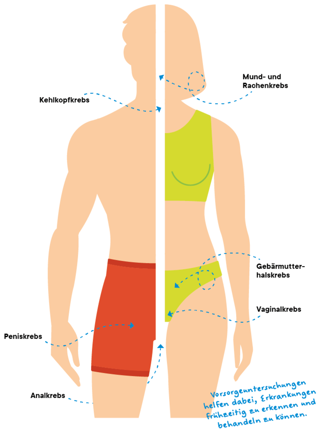 Illustration einer männlichen und einer weiblichen Figur, jeweils mit hervorgehobenen Bereichen, die auf Krebsrisiken hinweisen: Rachen, Mund, Gebärmutterhals, Vagina, Anus und Penis. Der deutsche Text weist auf die Bedeutung der Früherkennung durch Vorsorgeuntersuchungen hin.