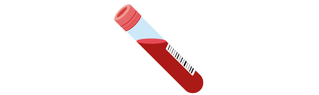 Abbildung einer Blutprobe in einem Reagenzglas mit rotem Deckel und seitlichem Barcode-Etikett, etwa zur Hälfte mit roter Flüssigkeit gefüllt, auf weißem Hintergrund.