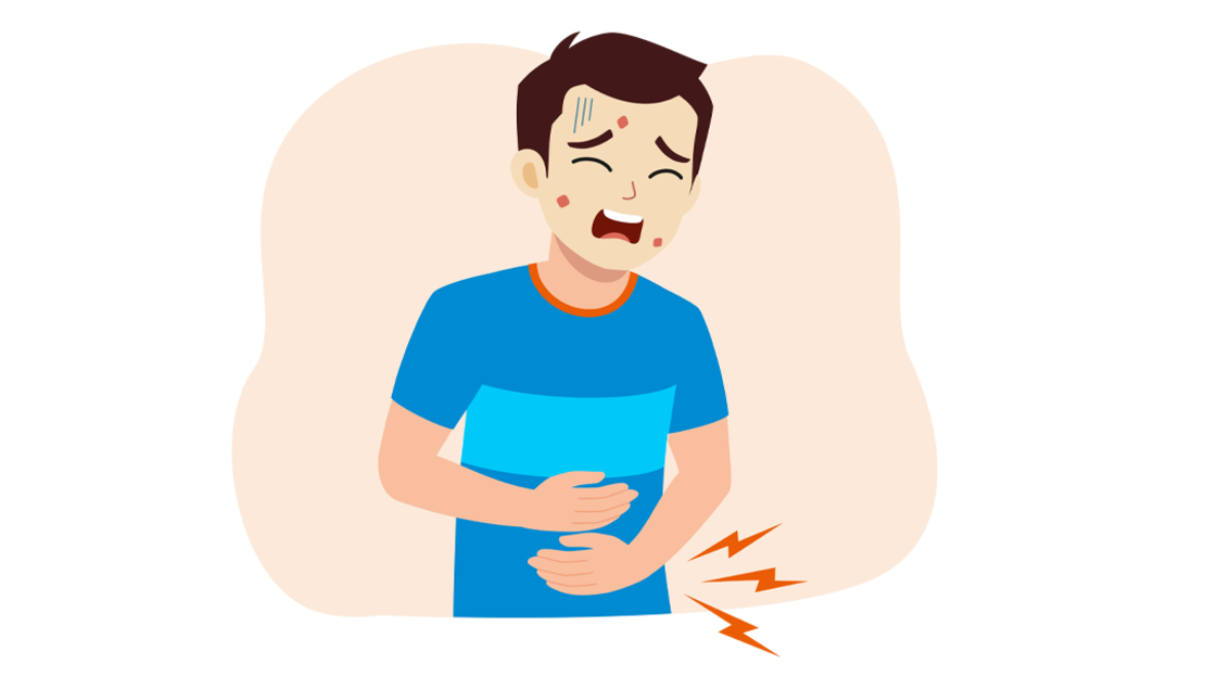 Ein Cartoon-Mann mit Akne und Schweiß im Gesicht hält sich vor Schmerzen den Bauch, wobei rote Zickzacklinien in der Nähe seines Bauches auf Bauchschmerzen hinweisen.