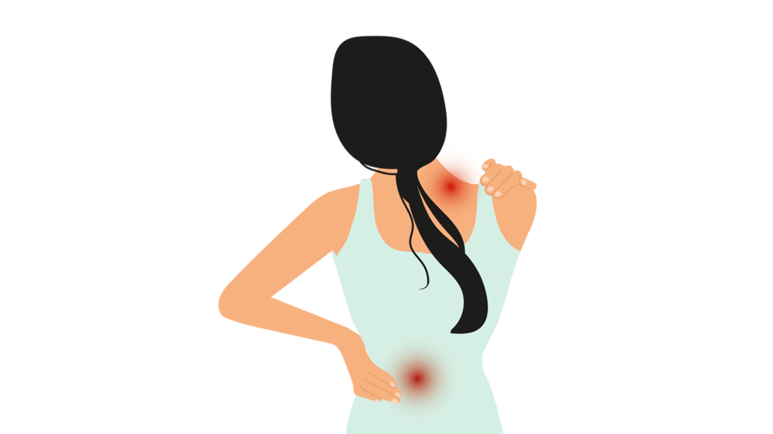 Illustration einer Person, die mit gesenktem Kopf sitzt und zwei rote, gereizte Flecken am Rücken und am Unterschenkel zeigt, die auf Schmerzen oder Verletzungen hindeuten.