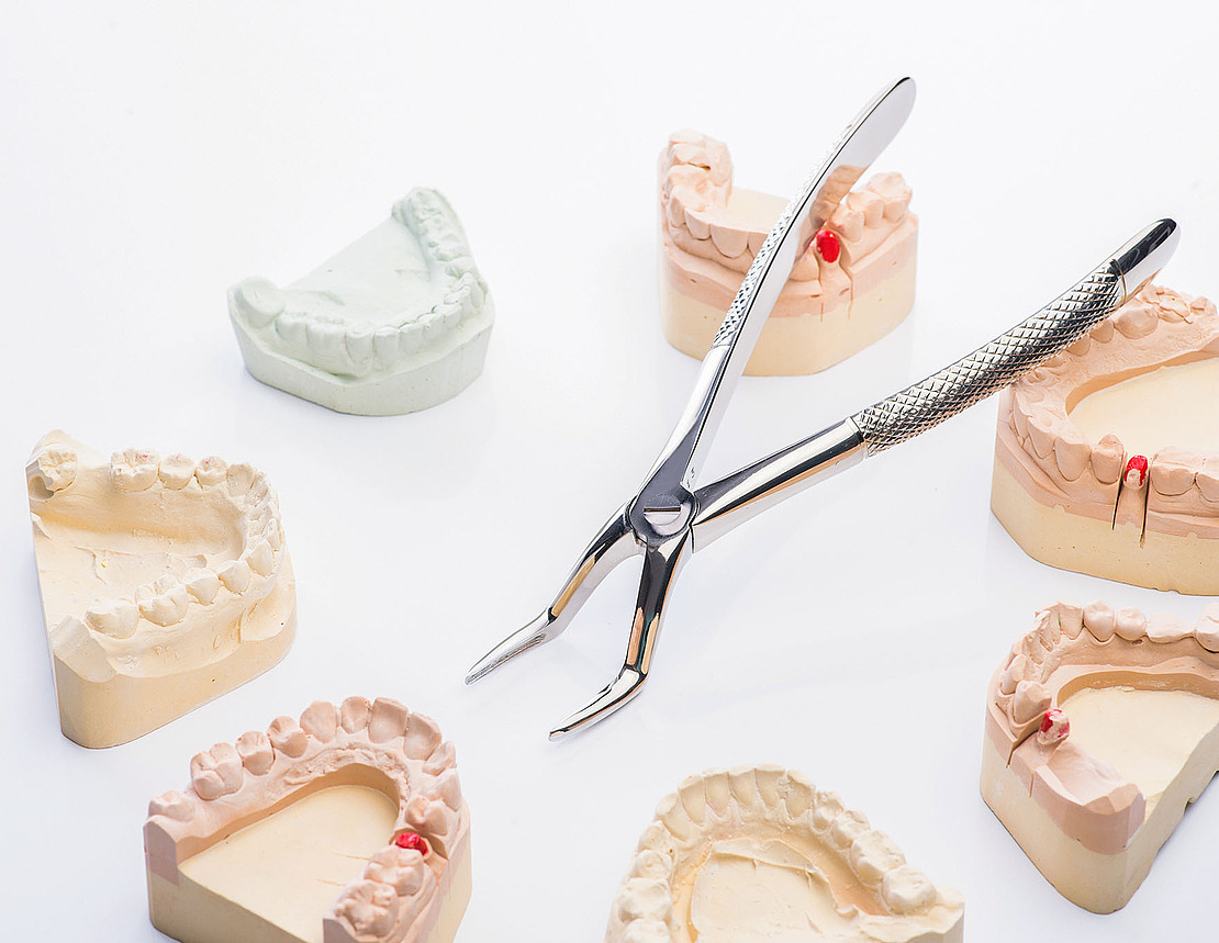 Eine Zahnzange liegt auf einer weißen Oberfläche, umgeben von mehreren Zahnabdrücken, einige mit roten Markierungen, die die relevanten Bereiche kennzeichnen.