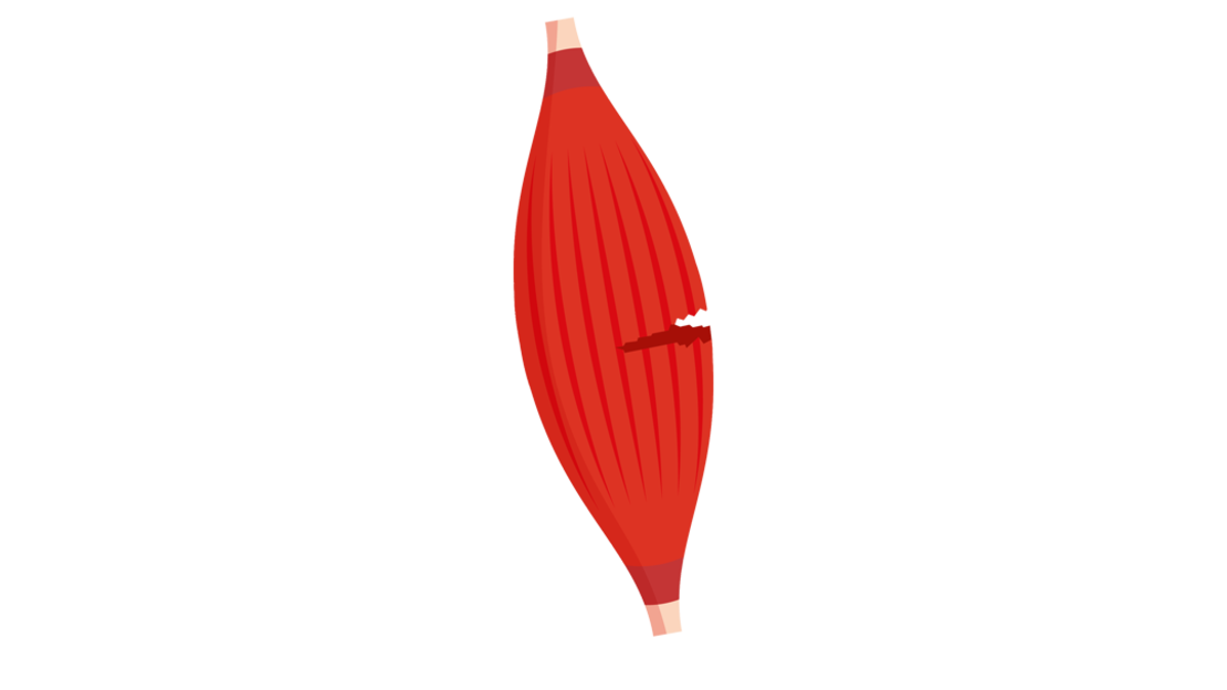 Abbildung einer roten, länglichen, gestreiften Skelettmuskelfaser mit verjüngten Enden auf weißem Hintergrund.