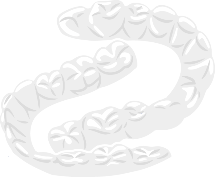 Ein Paar durchsichtiger Aligner wird übereinander gelegt, wobei die Umrisse der einzelnen Zähne auf jedem Aligner sichtbar sind.