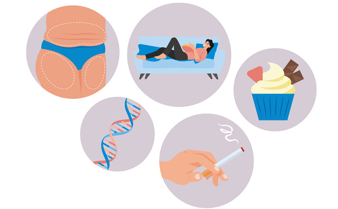 Abbildung mit den Risikofaktoren für Diabetes: Körperfett, sitzende Lebensweise, ungesunde Ernährung, Genetik (DNA-Strang) und Rauchen (Hand hält Zigarette), jeweils in separaten Kreisen.